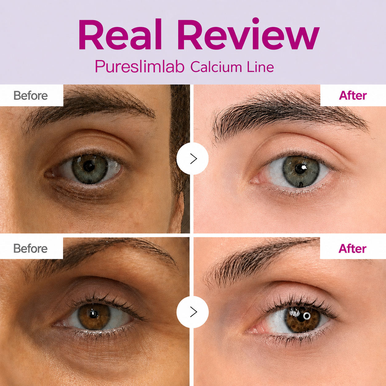 🔥LAST DAY 50% OFF!!Calcium Dark Spot Eye Cream