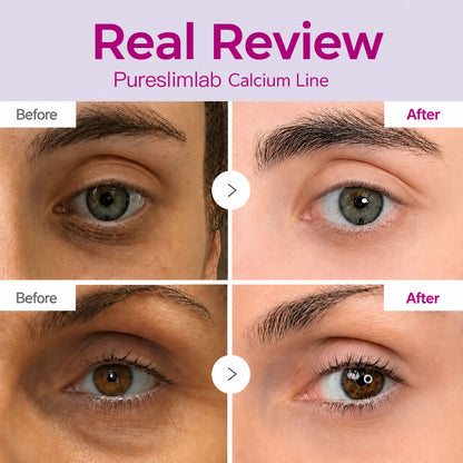 🔥LAST DAY 50% OFF!!Calcium Dark Spot Eye Cream