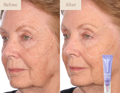 Eye Bag Instant Eraser, Tightens, Firms, & Blurs Wrinkles