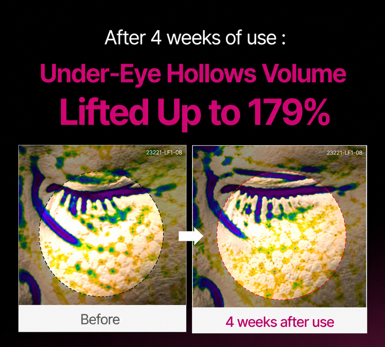 🔥LAST DAY 50% OFF!!Calcium Dark Spot Eye Cream