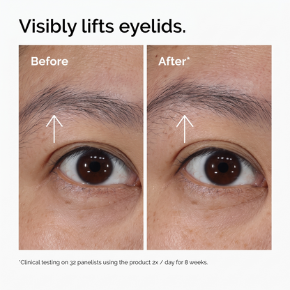 PDRN 4% + B9 Eye Cream