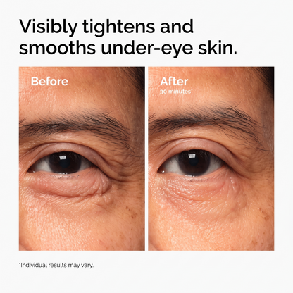 PDRN 4% + B9 Eye Cream